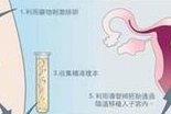 人工授精可以在家做吗？流程步骤有哪些